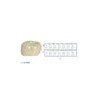 Corona zirconia nusmile posterior 1er molar y 2do molar