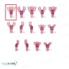Dentray porta impresiones(rosas)